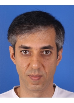 After Hair Transplant&nbsp;2 Sessions (Areas)